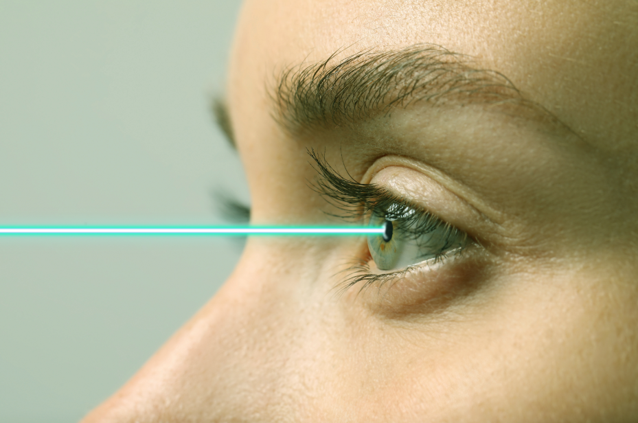 Laser Vision Correction